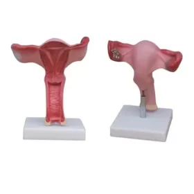 modelo-anatomico-de-utero-humano